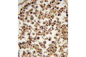 Formalin-fixed and paraffin-embedded human testis tissue reacted with ETV6 Antibody (N-term), which was peroxidase-conjugated to the secondary antibody, followed by DAB staining. (ETV6 抗体  (N-Term))