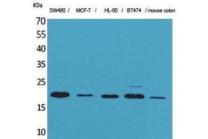 Western Blotting (WB) image for anti-Fibroblast Growth Factor 20 (FGF20) (Internal Region) antibody (ABIN3187718) (FGF20 抗体  (Internal Region))