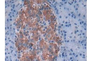 Immunohistochemistry (IHC) image for anti-Sorting Nexin 13 (SNX13) (AA 97-284) antibody (ABIN7434740)