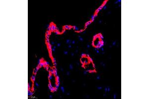 Immunofluorescent analysis of paraffin embedded mouse skin using CK6 (ABIN7074423) at dilution of 1: 2000 (Keratin 6 抗体)