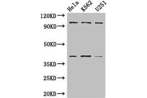 Western Blotting (WB) image for anti-Proteasome (Prosome, Macropain) 26S Subunit, Non-ATPase, 2 (PSMD2) (AA 401-700), (Regulatory Subunit 2) antibody (ABIN7142208)