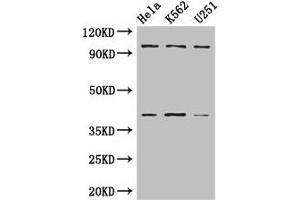 Western Blot Positive WB detected in: Hela whole cell lysate, K562 whole cell lysate, U251 whole cell lysate All lanes: PSMD2 antibody at 3 μg/mL Secondary Goat polyclonal to rabbit IgG at 1/50000 dilution Predicted band size: 101, 83, 86 kDa Observed band size: 101, 40 kDa
