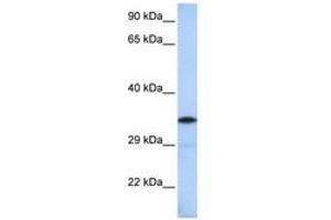 Image no. 1 for anti-BTB (POZ) Domain-Containing Protein KCTD4 (KCTD4) (AA 144-193) antibody (ABIN6742587) (KCTD4 抗体  (AA 144-193))