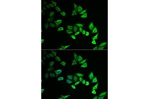Immunofluorescence analysis of U2OS cell using MYOZ2 antibody. (MYOZ2 抗体)