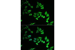 Immunofluorescence analysis of U2OS cell using MYOZ2 antibody.