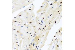 Immunohistochemistry (IHC) image for anti-Zinc Finger and BTB Domain Containing 17 (ZBTB17) (AA 121-360) antibody (ABIN6150370)