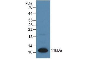 Detection of Recombinant S100, Human using Polyclonal Antibody to S100 Calcium Binding Protein (S100) (S100 Protein (S100) (AA 1-94) 抗体)