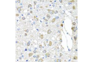 Immunohistochemistry of paraffin-embedded rat brain using BAG5 antibody at dilution of 1:100 (x40 lens). (BAG5 抗体)