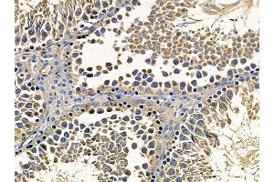 ABIN7095203 and ABIN7099259 at 1/100 staining rat testis tissue by IHC-P.