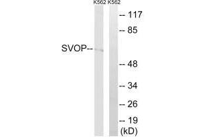 Western blot analysis of extracts from K562 cells, using SVOP antibody. (SVOP 抗体)