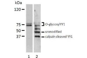 Western blot analysis of total cell lysate (200 µg) from serum stimulated bovine endothelial cells (lane 1) and HeLa cells (lane 2) probed with chicken anti-human YY1 antibody. (YY1 抗体  (full length))