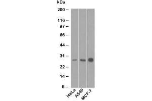 Western blot testing of human samples with Bcl-2 antibody (8C8). (Bcl-2 抗体  (AA 41-54))
