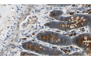 ABIN6274427 at 1/100 staining Mouse intestine tissue by IHC-P. (CAMKV 抗体  (Internal Region))
