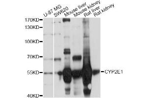 Western blot analysis of extracts of various cell lines, using CYP2E1 Antibody (ABIN5971187) at 1/1000 dilution. (CYP2E1 抗体)