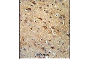 RGR Antibody (Center) (ABIN653851 and ABIN2843113) IHC analysis in formalin fixed and paraffin embedded brain tissue followed by peroxidase conjugation of the secondary antibody and DAB staining. (RGR 抗体  (AA 265-291))