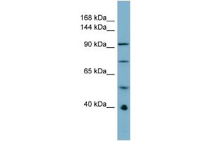 Host:  Rabbit  Target Name:  RBBP6  Sample Type:  ACHN Whole cell lysates  Antibody Dilution:  1. (RBBP6 抗体  (N-Term))