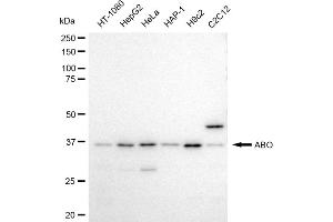 Western blotting analysis using ABO antibody (ABIN7798919).