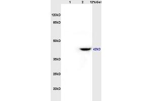 Lane 1: rat brain lysates Lane 2: rat heart lysates probed with Anti CD84/SLAMF5 Polyclonal Antibody, Unconjugated (ABIN741465) at 1:200 in 4 °C. (CD84 抗体  (AA 231-329))