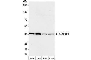 Western Blotting (WB) image for anti-Glyceraldehyde-3-Phosphate Dehydrogenase (GAPDH) (AA 250-300) antibody (ABIN7453833)
