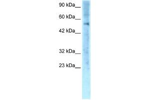 WB Suggested Anti-ZNF500 Antibody Titration: 0. (ZNF500 抗体  (Middle Region))
