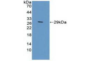 Detection of Recombinant TFR2, Mouse using Polyclonal Antibody to Transferrin Receptor 2 (TFR2) (Transferrin Receptor 2 抗体  (AA 86-259))