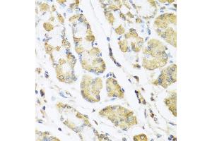 Immunohistochemistry of paraffin-embedded human stomach using MLN antibody (ABIN5973790) at dilution of 1/100 (40x lens). (Motilin 抗体)