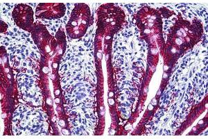 Human Intestine: Formalin-Fixed, Paraffin-Embedded (FFPE) (EpCAM 抗体)