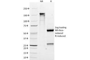 SDS-PAGE Analysis Purified MART-1 Monoclonal Antibody (M2-7C10). (MLANA 抗体)