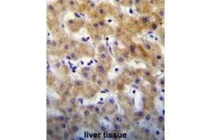 KTAP2 Antibody (C-term) immunohistochemistry analysis in formalin fixed and paraffin embedded human liver tissue followed by peroxidase conjugation of the secondary antibody and DAB staining. (KRTCAP2 抗体  (C-Term))