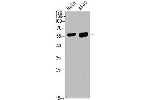 Western blot analysis of HELA A549 Cell Lysate, antibody was diluted at 1:1000. (DCT 抗体  (AA 1268-1341))