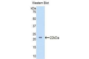 Western Blotting (WB) image for anti-Lanosterol Synthase (2,3-Oxidosqualene-Lanosterol Cyclase) (LSS) (AA 388-549) antibody (ABIN1860102) (LSS 抗体  (AA 388-549))