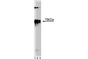 Western Blotting (WB) image for anti-Protein Kinase C, delta (PKCd) (AA 114-289) antibody (ABIN967943) (PKC delta 抗体  (AA 114-289))
