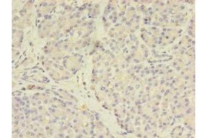 Immunohistochemistry of paraffin-embedded human pancreatic tissue using ABIN7159505 at dilution of 1:100 (STEAP3 抗体  (AA 1-207))