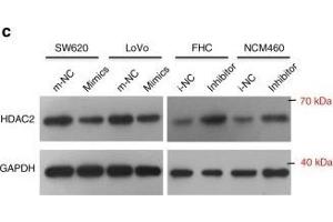 miR-500a-5p suppresses cell proliferation and invasion by targeting HDAC2 in vitro. (HDAC2 抗体  (C-Term))