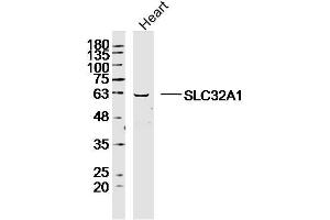Image no. 1 for anti-Solute Carrier Family 32 (GABA Vesicular Transporter), Member 1 (SLC32A1) (AA 351-450) antibody (ABIN5675555)