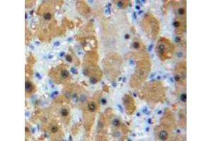 IHC-P analysis of Liver tissue, with DAB staining. (LRP1 抗体  (AA 692-962))