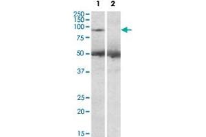 USP6 polyclonal antibody (2 ug/mL) staining of human placenta lysate (35 ug protein in RIPA buffer) with (lane 2) and without (lane 1) blocking with the immunizing peptide.