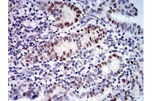 Immunohistochemistry (IHC) image for anti-Ubiquitin Fusion Degradation Protein 1 Homolog (UFD1L) (AA 208-307) antibody (ABIN5542401)