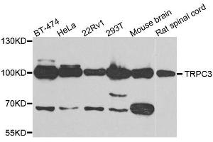 Western blot analysis of extracts of various cell lines, using TRPC3 antibody. (TRPC3 抗体)