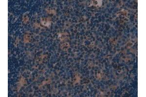 IHC-P analysis of Mouse Lymph node Tissue, with DAB staining. (Involucrin 抗体  (AA 301-460))