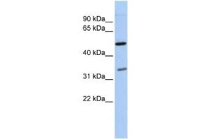 Western Blotting (WB) image for anti-Polyglutamine Binding Protein 1 (PQBP1) antibody (ABIN2457939) (PQBP1 抗体)