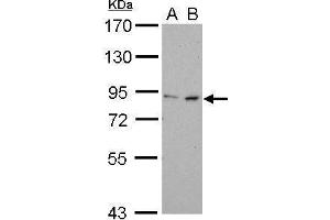 WB Image FOXM1 antibody detects FOXM1 protein by Western blot analysis. (FOXM1 抗体  (N-Term))