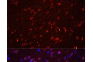 Immunofluorescence analysis of Rat brain using GRIN2B Polyclonal Antibody at dilution of 1:100. (GRIN2B 抗体)