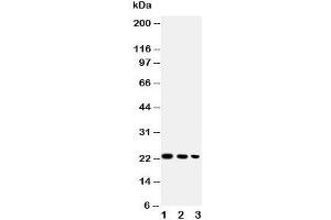 Western blot testing of BAFF antibody and Lane 1:  recombinant human protein 10ng;  2: 5ng;  3: 2. (BAFF 抗体  (AA 265-285))