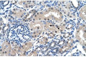 Human kidney (FKBP6 抗体  (Middle Region))