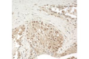 anti-Zinc Finger, CCHC Domain Containing 11 (ZCCHC11) (AA 250-300) antibody