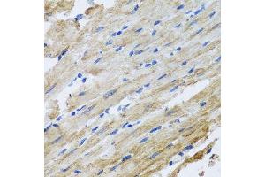 Immunohistochemistry (Paraffin-embedded Sections) (IHC (p)) image for anti-Synaptosomal-Associated Protein, 29kDa (SNAP29) (AA 1-258) antibody (ABIN1682838)