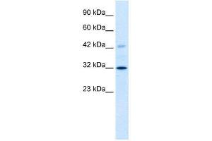 WB Suggested Anti-VDAC1  Antibody Titration: 1. (VDAC1 抗体  (C-Term))