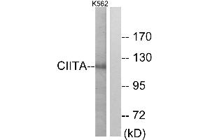 Western blot analysis of extracts from K562 cells, using CIITA antibody. (CIITA 抗体  (Internal Region))