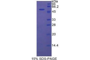SDS-PAGE analysis of Rat BRCA1 Protein. (BRCA1 蛋白)